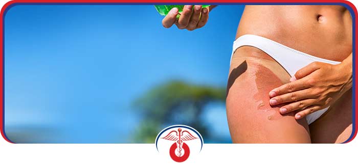 Sunburn Treatment Clinic Near Me in Anaheim CA