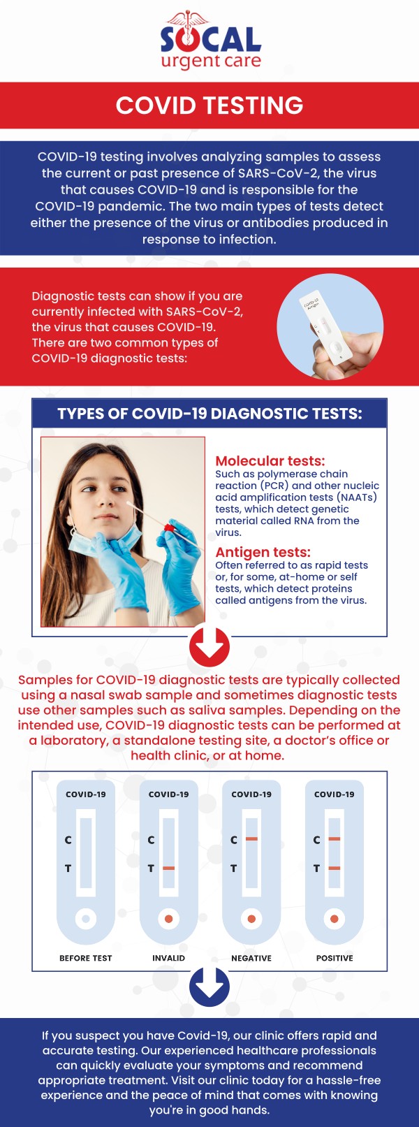 COVID-19 testing aids in the prevention and limitation of the virus. People who experience fever, cough, shortness of breath, fatigue, headache, sore throat, and loss of taste or smell, may have COVID-19. We are offering COVID-19 testing at our urgent care clinic. We are also open to all your urgent care needs. You can walk in, make an appointment online, or see us via telemedicine. We are conveniently located at 710 S Brookhurst St. Suite A, Anaheim, CA 92804. Contact us today for more information! COVID-19 testing aids in the prevention and limitation of the virus. People who experience fever, cough, shortness of breath, fatigue, headache, sore throat, and loss of taste or smell, may have COVID-19. We are offering COVID-19 testing at our urgent care clinic. We are also open to all your urgent care needs. You can walk in, make an appointment online, or see us via telemedicine. We are conveniently located at 710 S Brookhurst St. Suite A, Anaheim, CA 92804. Contact us today for more information!