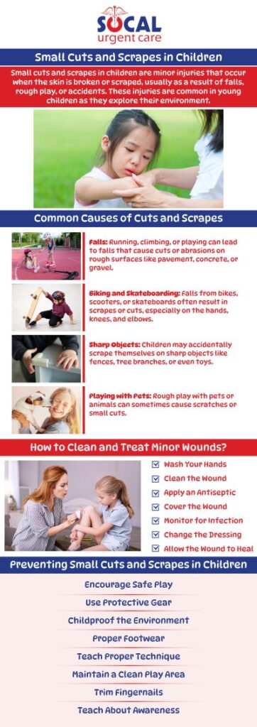 When you need stitches, SoCal Urgent Care is the right place to visit. Most cuts aren't life-threatening, but they do require immediate attention. You do not need to make an appointment at our clinic; our trained team of professionals may assist you swiftly and affordably. At SoCal Urgent Care and walk-in clinic, we provide lacerations, cuts, and stitches treatment for children and adults. We are open 7 days a week! For more information, please contact us or request an appointment online. We are conveniently located at 710 S Brookhurst St. Suite A, Anaheim, CA 92804.